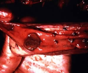 duck viral enteritis enlarged spleen