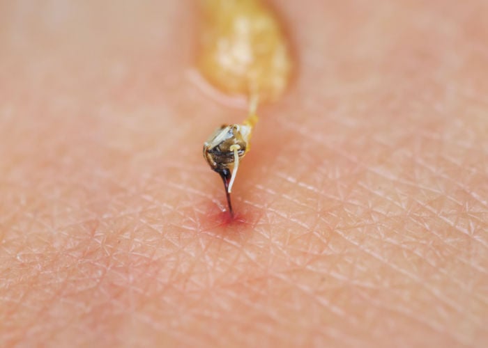 bee sting with stinger left on skin